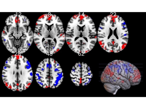 how cold plunge might affect epilepsy