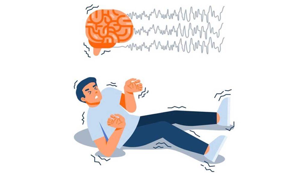 what is epilepsy